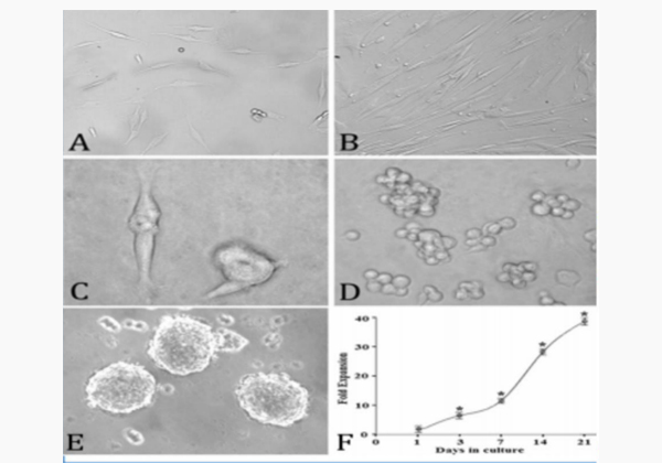 The transdifferentiation process of human umbilical cord mesenchymal stem cells (HUMSCs) into NSCs
