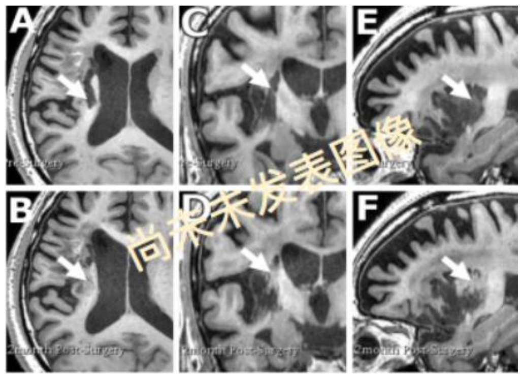 1763718387310086.png WX20251121-174618@2x.png